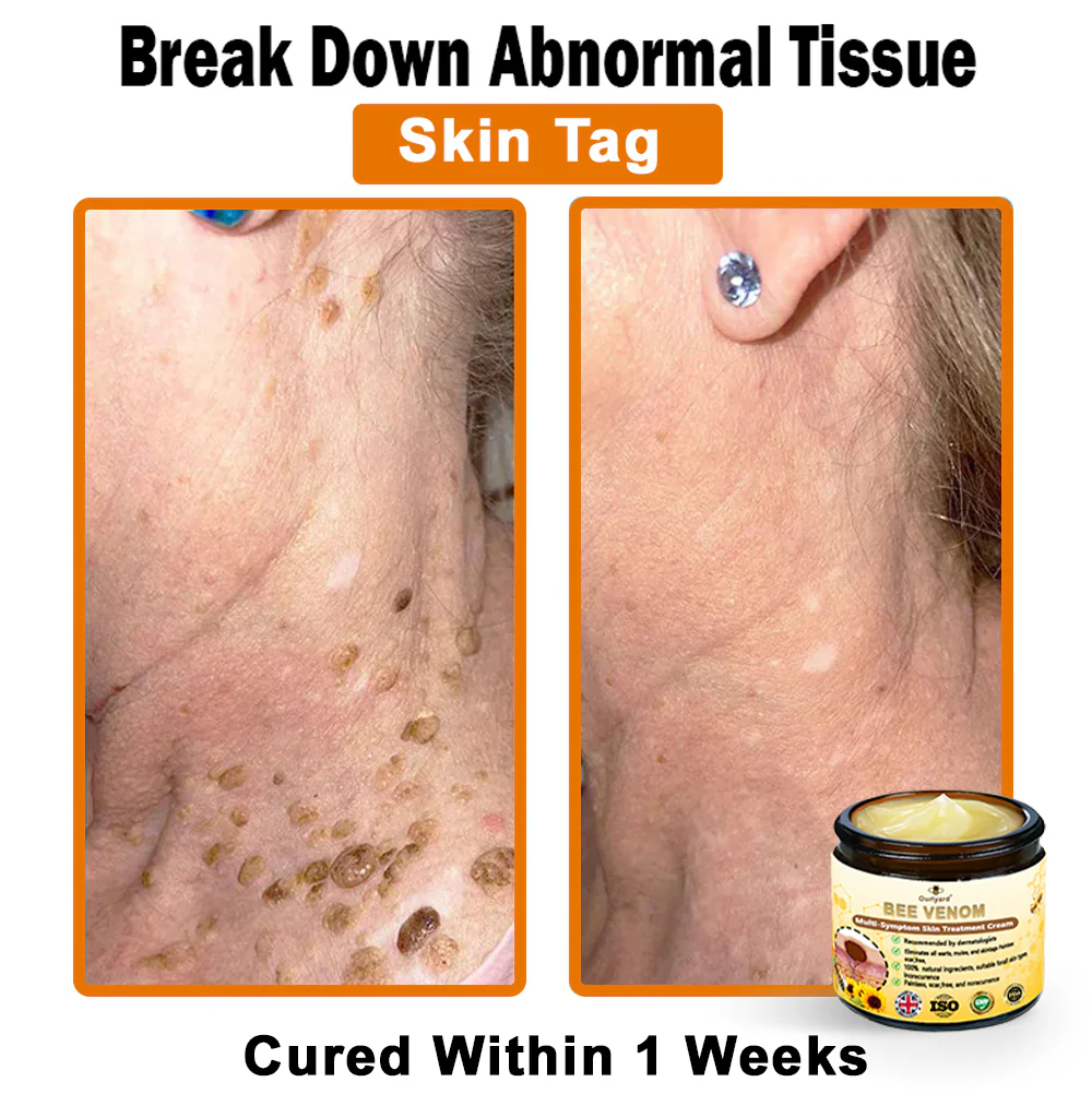 Bee Venom Multi-Symptom Skin Treatment Cream - Image 2