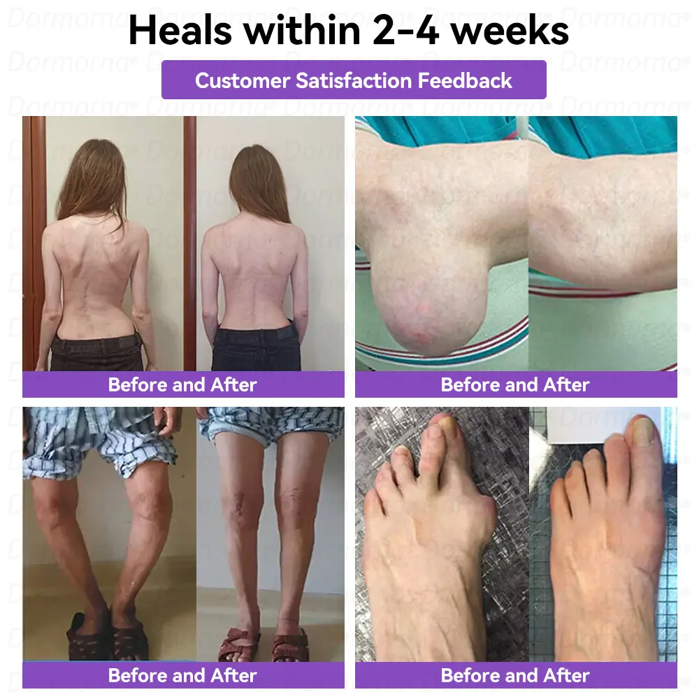 ๐๐๐๐๐ข๐ก๐๐๐ & ๐ต๐๐ก๐๐ฅ ๐๐๐๐ ๐ฝ๐๐๐๐ก ๐๐๐ก๐โ - Image 4