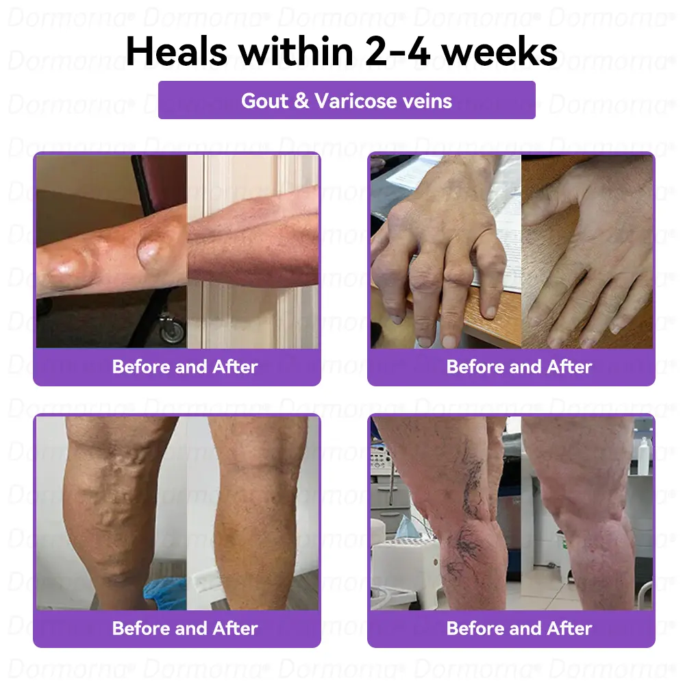 ๐๐๐๐๐ข๐ก๐๐๐ & ๐ต๐๐ก๐๐ฅ ๐๐๐๐ ๐ฝ๐๐๐๐ก ๐๐๐ก๐โ - Image 5