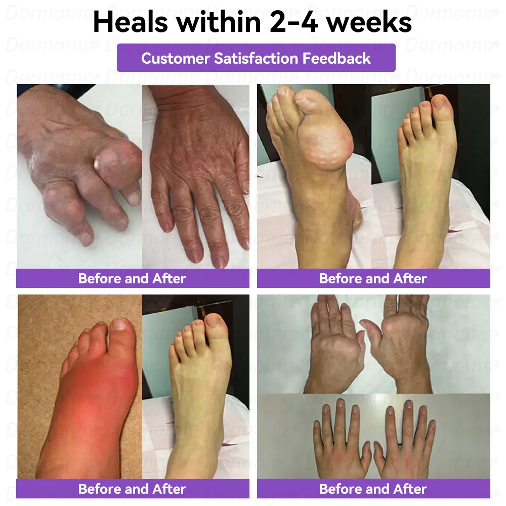 ๐๐๐๐๐ข๐ก๐๐๐ & ๐ต๐๐ก๐๐ฅ ๐๐๐๐ ๐ฝ๐๐๐๐ก ๐๐๐ก๐โ - Image 6