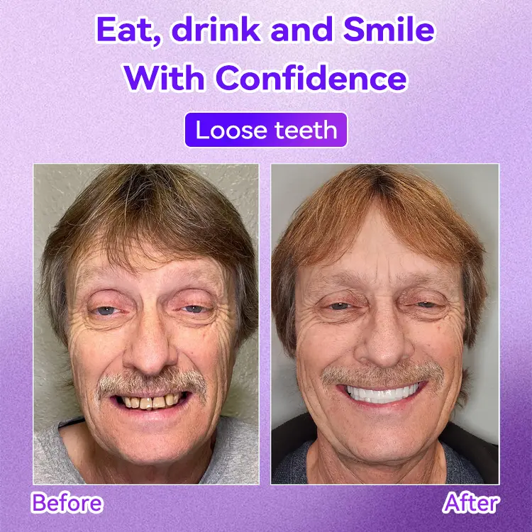 ๐๐๐๐กโ ๐
๐๐ ๐ก๐๐๐๐ก๐๐๐ ๐๐๐๐๐๐๐ ๐๐๐ค๐๐๐ - Image 4