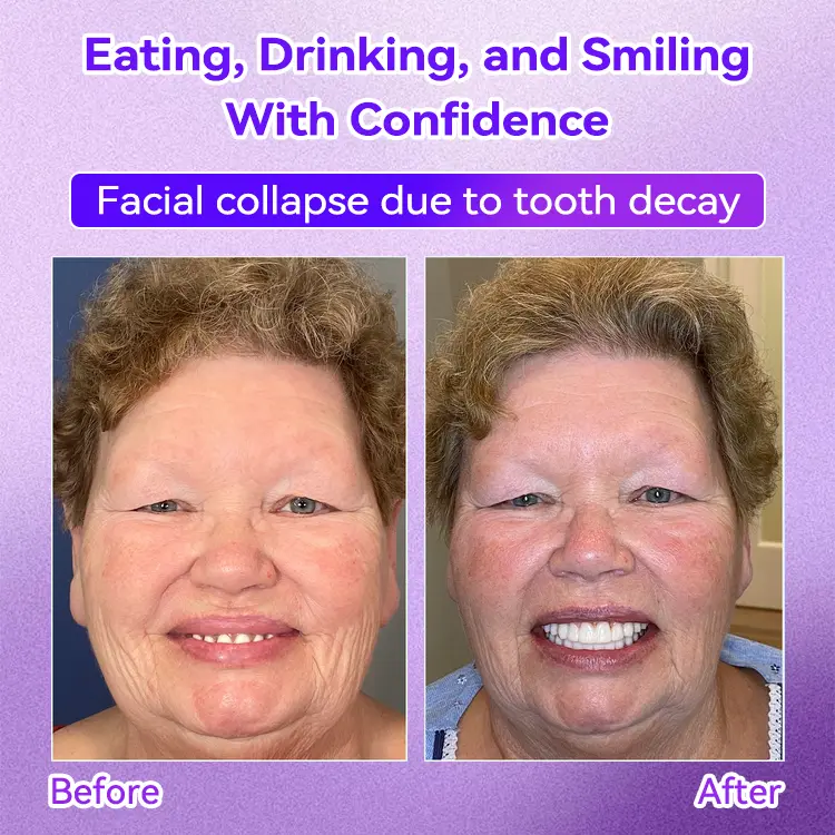 ๐๐๐๐กโ ๐
๐๐ ๐ก๐๐๐๐ก๐๐๐ ๐๐๐๐๐๐๐ ๐๐๐ค๐๐๐ - Image 7