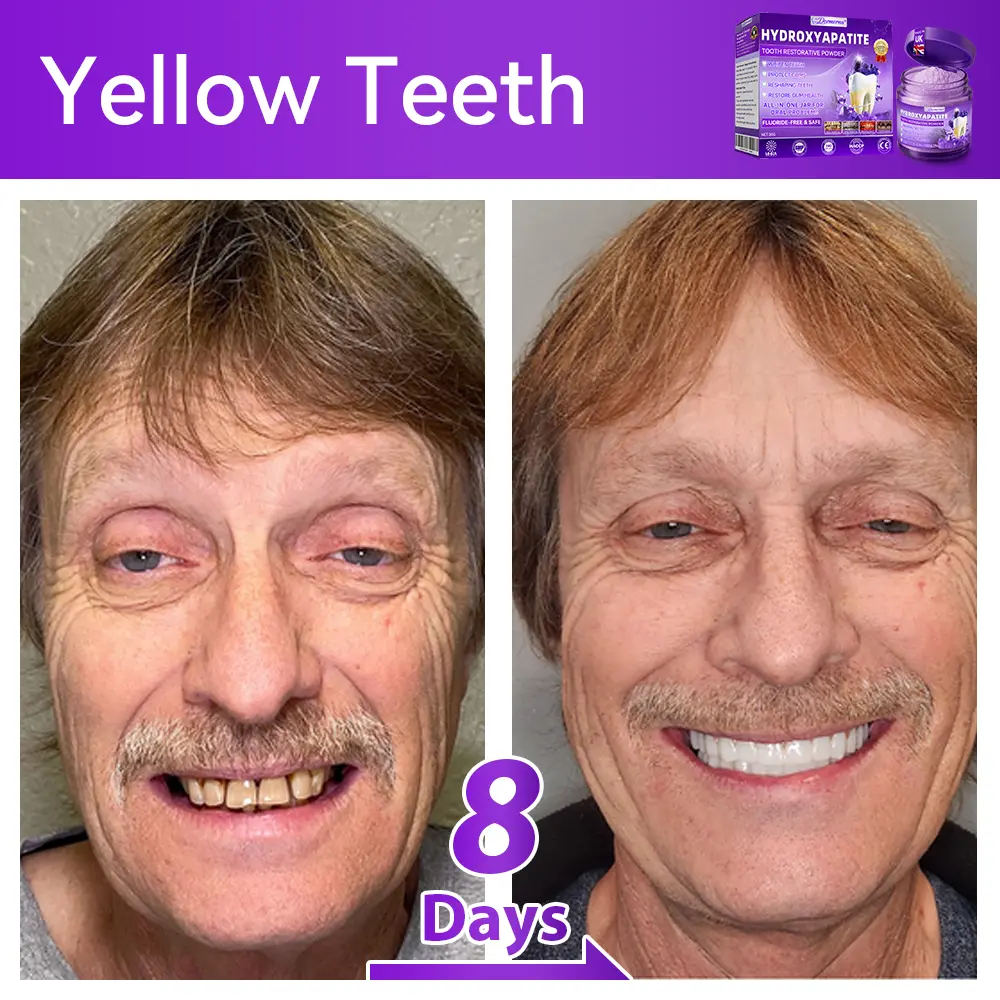 ๐ป๐ฆ๐๐๐๐ฅ๐ฆ๐๐๐๐ก๐๐ก๐ ๐๐๐๐กโ ๐
๐๐ ๐ก๐๐๐๐ก๐๐ฃ๐ ๐๐๐ค๐๐๐ - Image 2