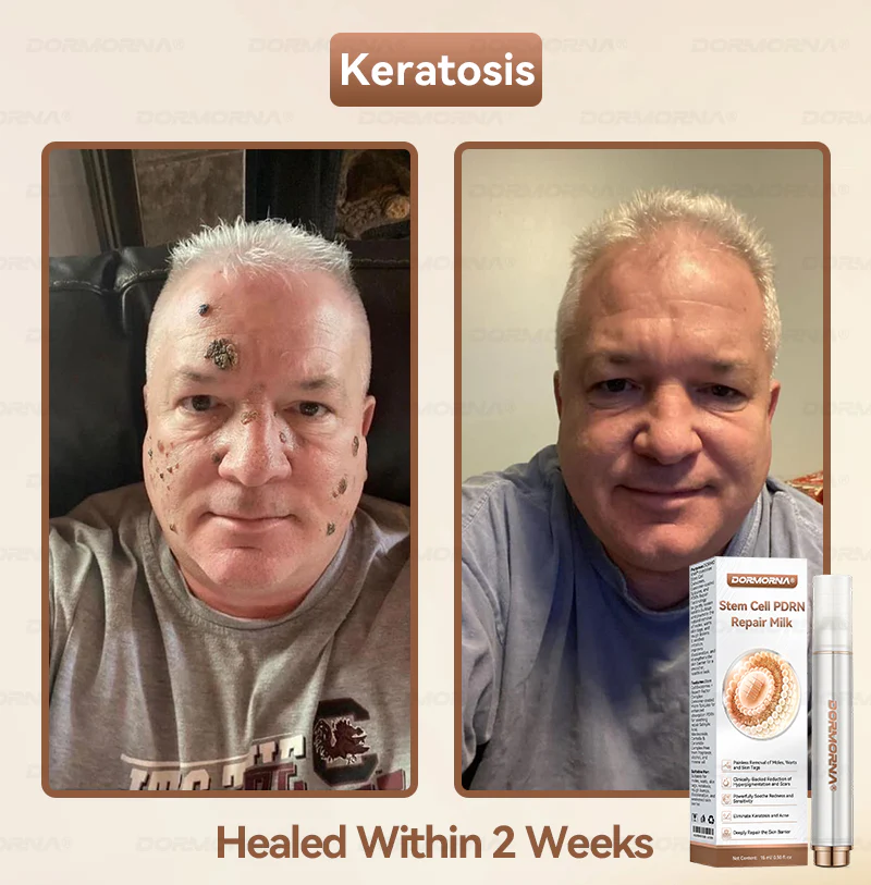 ๐๐ฑ๐จ๐ฌ๐จ๐ฆ๐-๐๐ง๐๐ฎ๐ฌ๐๐ ๐๐จ๐ซ ๐๐ค๐ข๐ง ๐๐๐ ๐๐ง๐๐ซ๐๐ญ๐ข๐จ๐ง & ๐๐ฆ๐ฉ๐๐ซ๐๐๐๐ญ๐ข๐จ๐ง ๐๐จ๐ซ๐ซ๐๐๐ญ๐ข๐จ๐ง - Image 4