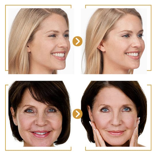 Anti-Wrinkle White Face Rice Serum - Image 5