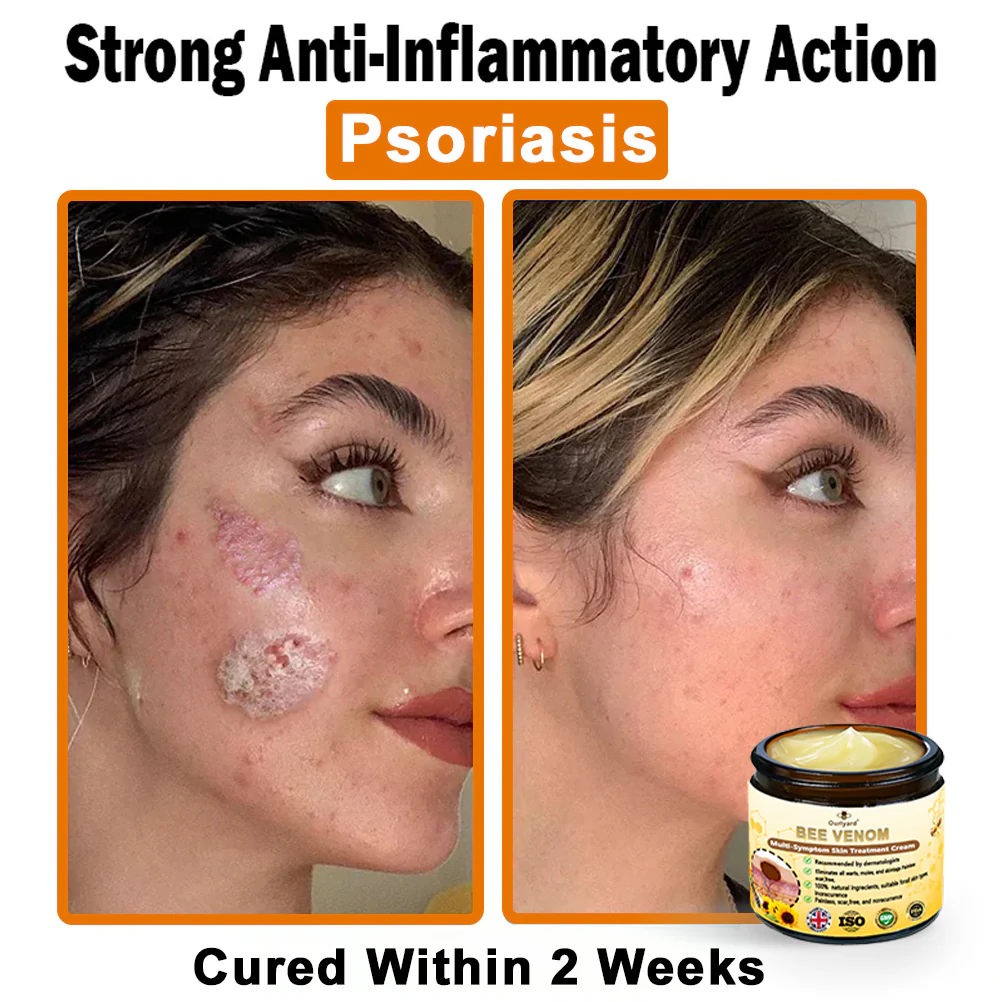 Bee Venom Multi-Symptom Skin Treatment Cream - Image 4