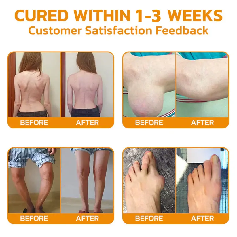 ๐๐จ๐ญ๐ฎ๐ฅ๐ข๐ง๐ฎ๐ฆ ๐๐จ๐ฑ๐ข๐ง & ๐๐๐ ๐๐๐ง๐จ๐ฆ ๐๐๐ข๐ง-๐๐๐ฅ๐ข๐๐ ๐๐จ๐ง๐ ๐๐๐๐ฅ๐ข๐ง๐ ๐๐ซ๐๐๐ฆ - Image 4