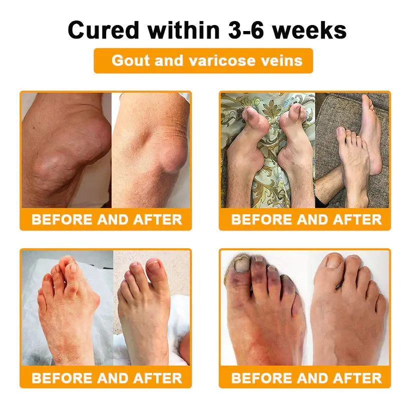 ๐๐จ๐ญ๐ฎ๐ฅ๐ข๐ง๐ฎ๐ฆ ๐๐จ๐ฑ๐ข๐ง & ๐๐๐ ๐๐๐ง๐จ๐ฆ ๐๐๐ข๐ง-๐๐๐ฅ๐ข๐๐ ๐๐จ๐ง๐ ๐๐๐๐ฅ๐ข๐ง๐ ๐๐ซ๐๐๐ฆ - Image 6