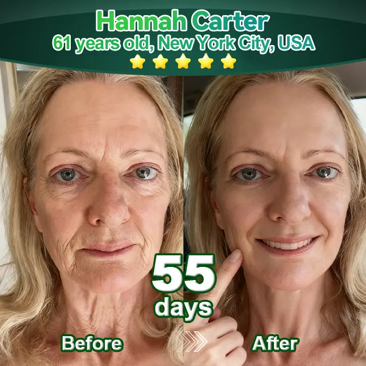 Luxurious Collagen & Stem Cell Anti-Cellulite Massage Oil - Image 3