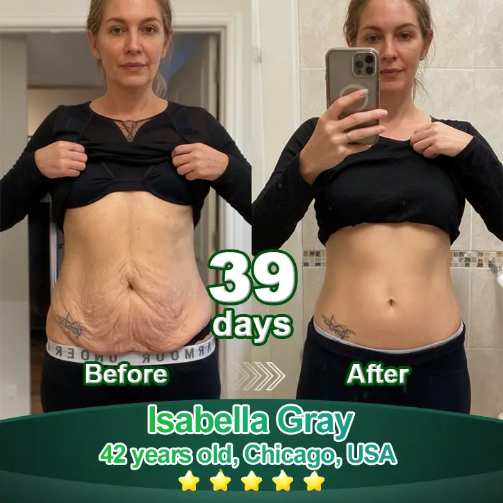 Luxurious Collagen & Stem Cell Anti-Cellulite Massage Oil - Image 5