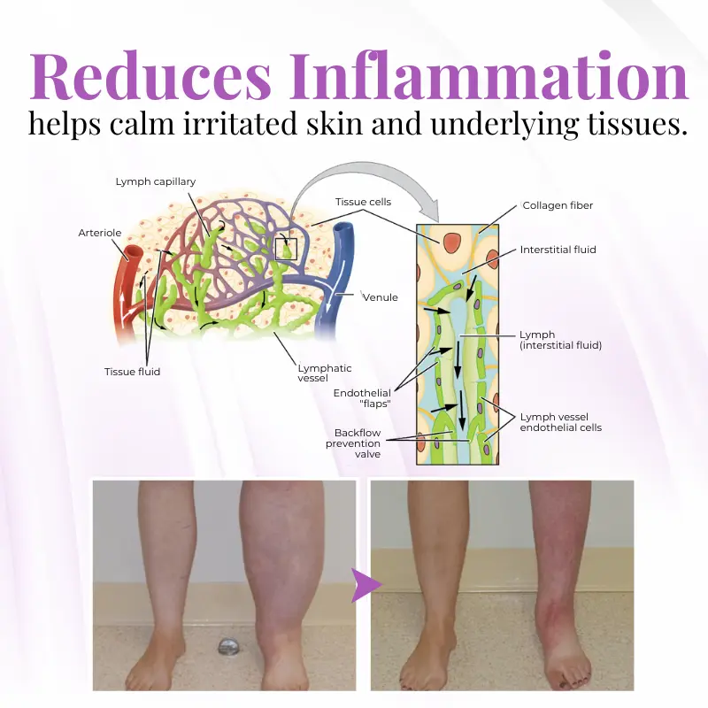 VascuSoothe Leg Care Phyto Cream - Image 4