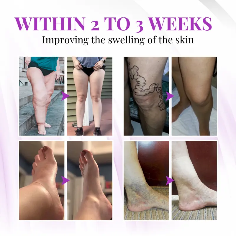 VascuSoothe Leg Care Phyto Cream - Image 8