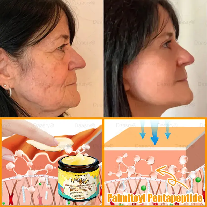 Bee Venom Treatment Cream - Image 12