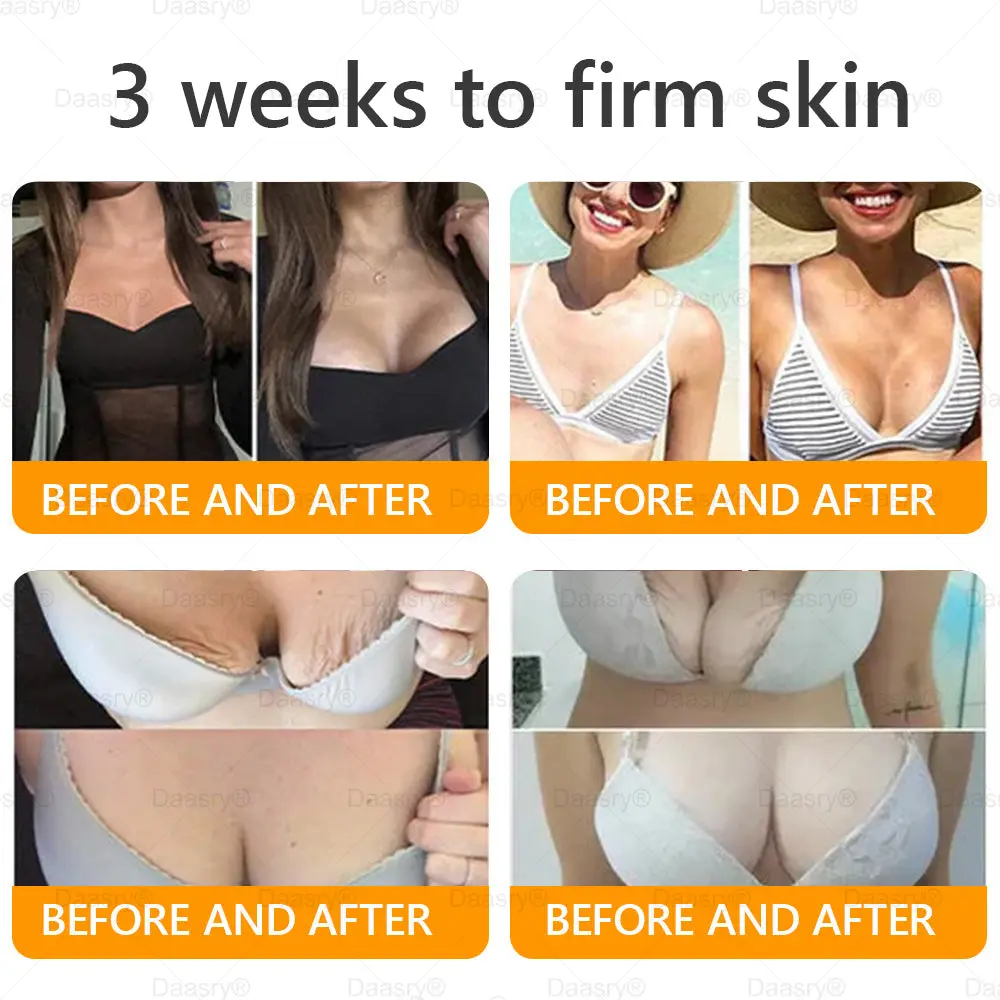 Bee Venom Treatment Cream - Image 4