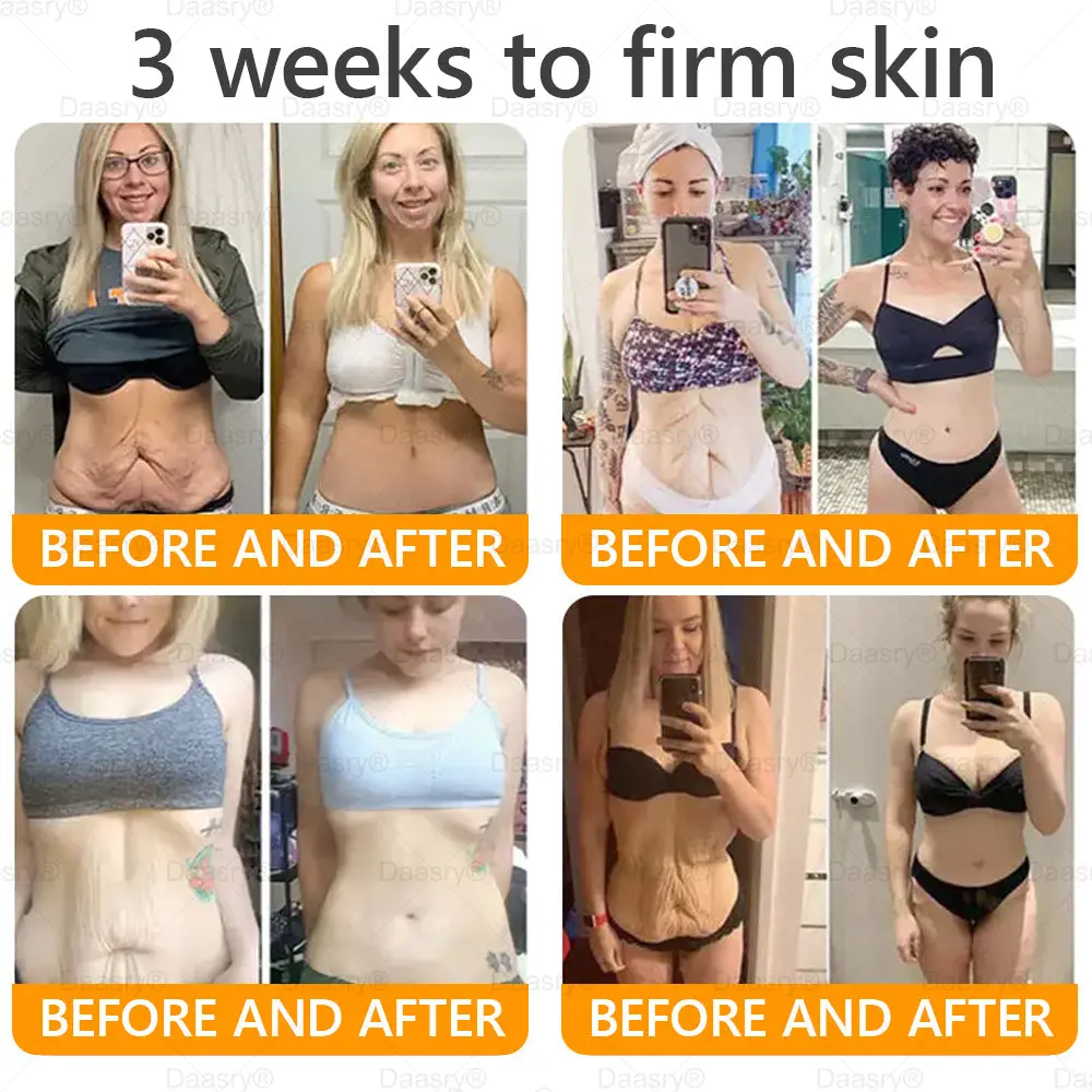 Bee Venom Treatment Cream - Image 5