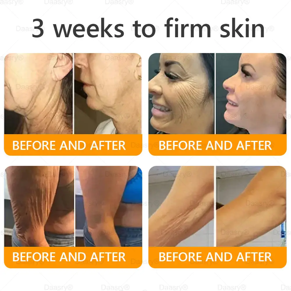 Bee Venom Treatment Cream - Image 7