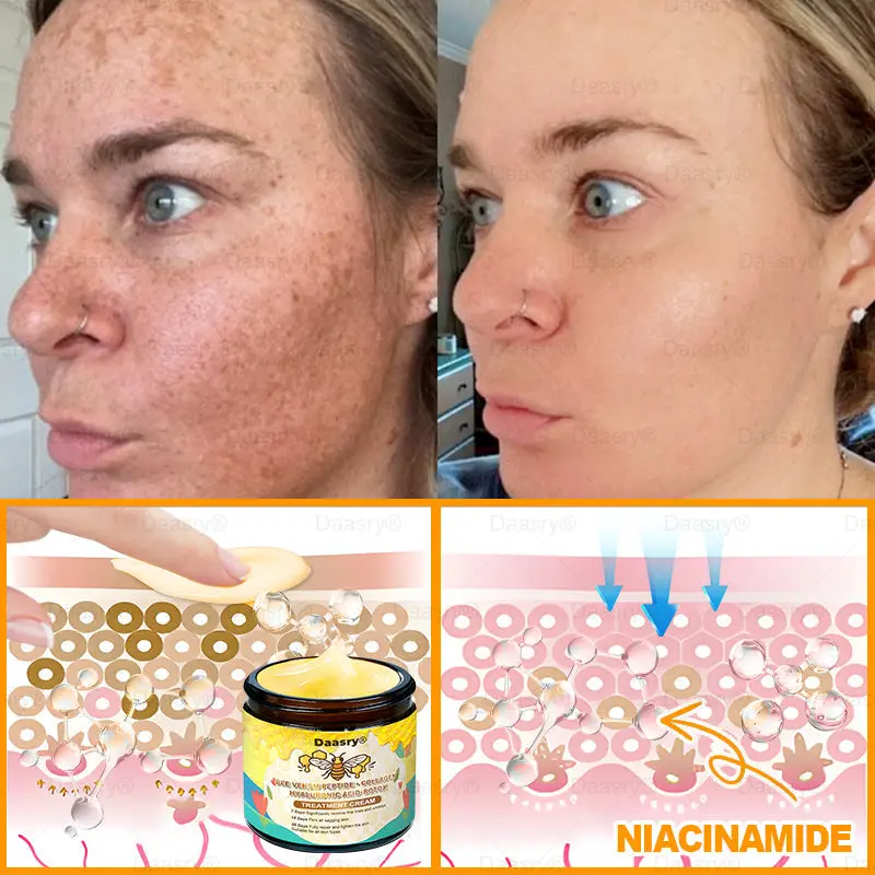 Bee Venom Treatment Cream with bee venom peptides, botulinum toxin, hyaluronic acid, and collagen. Targets wrinkles, fine lines, sagging, stretch marks, dark spotsfirming, lifting and more - Image 8