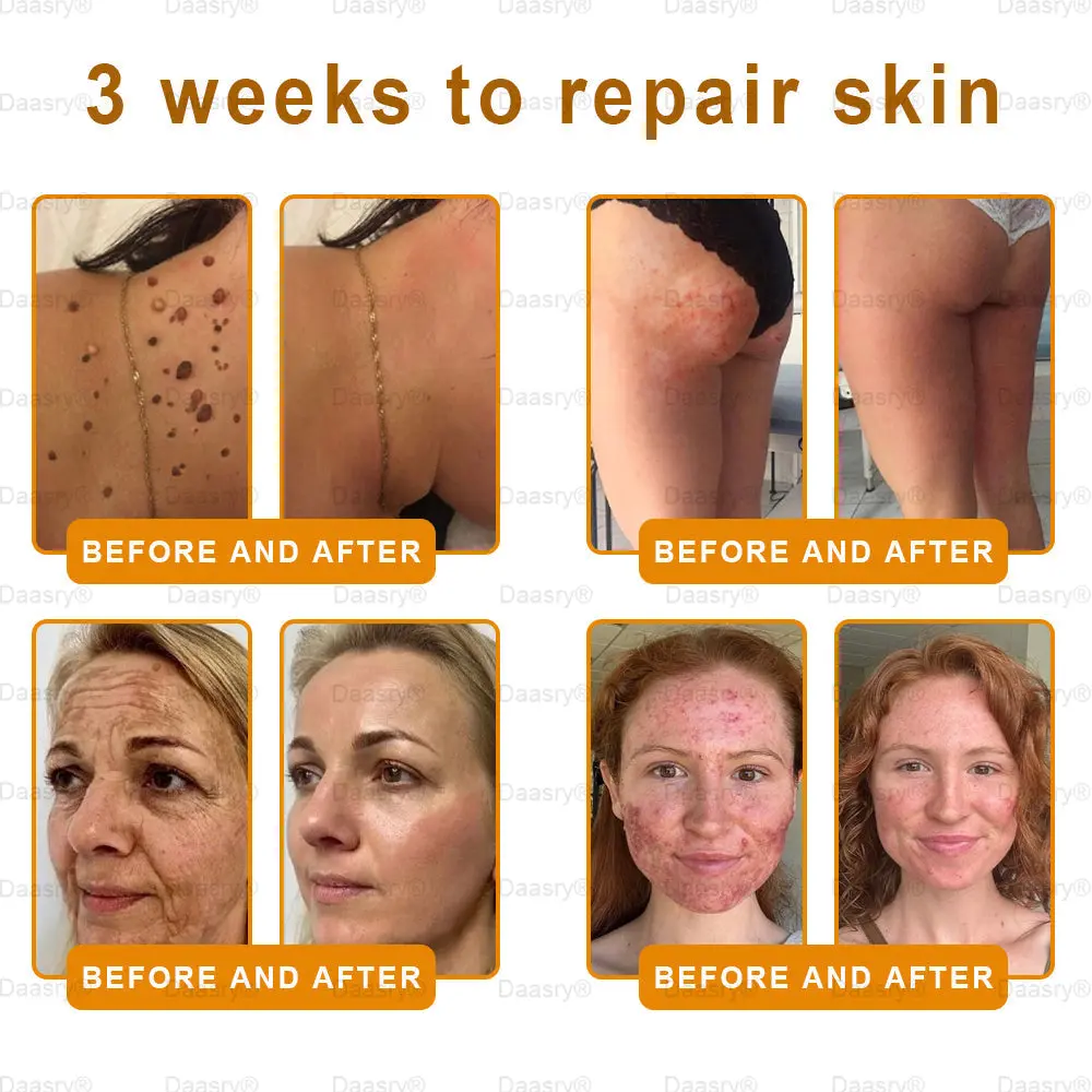 Botox Bee Venom Skin Restoration Cream - Image 4