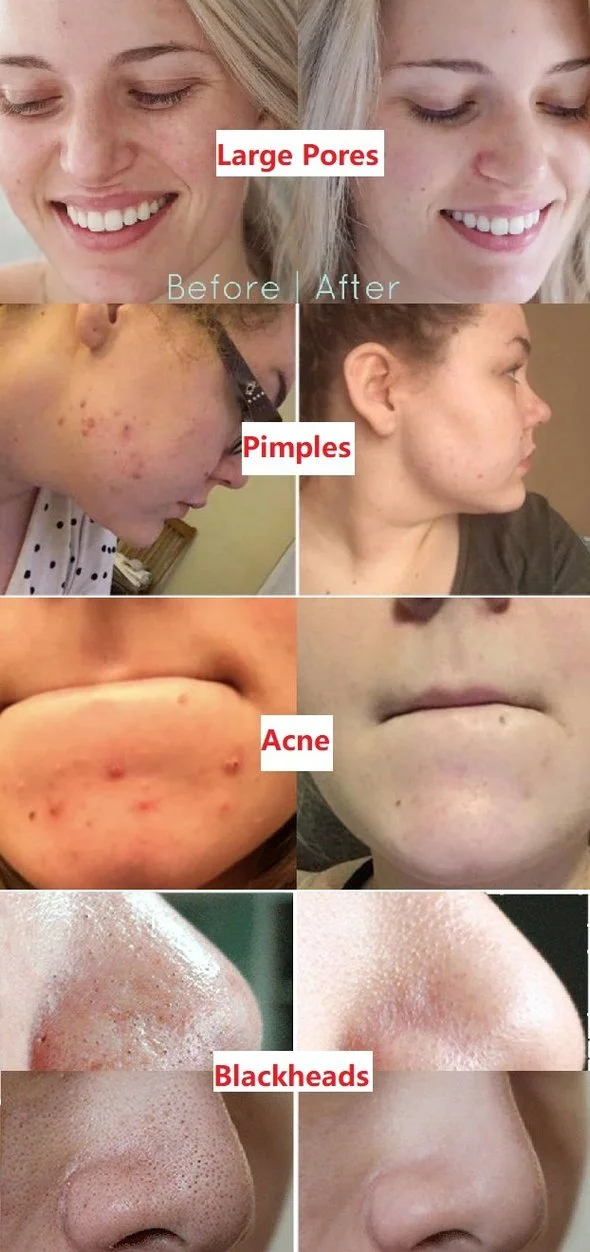 100% Natural Green Tea Deep Cleanse Mask - Image 2