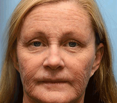 Botox Bee Venom Wrinkle Firming Multi-Purpose Cream - Image 15