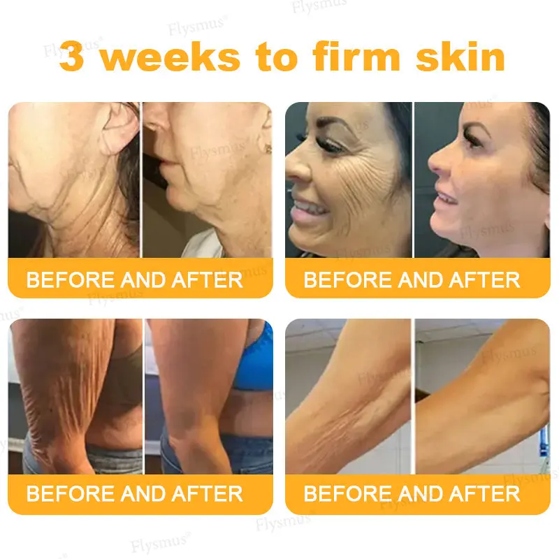 Botox Bee Venom Wrinkle Firming Multi-Purpose Cream - Image 6