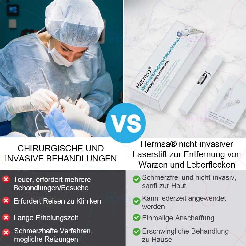 non-invasive laser pointer - mole and wart removal - Image 12