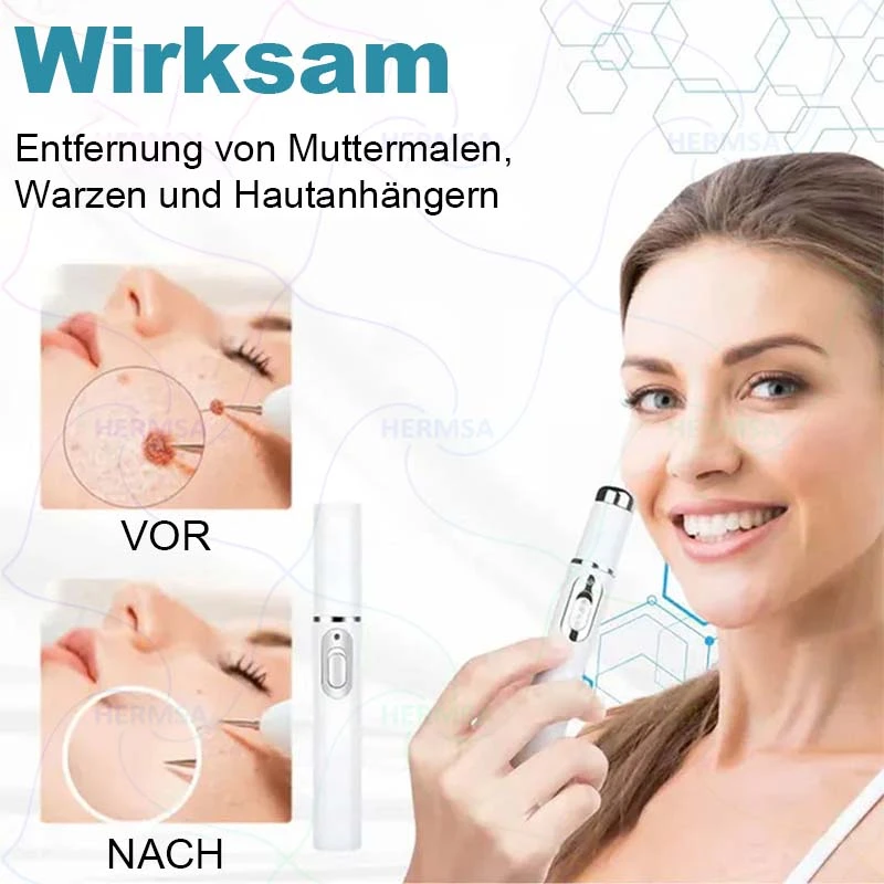 non-invasive laser pointer - mole and wart removal - Image 13