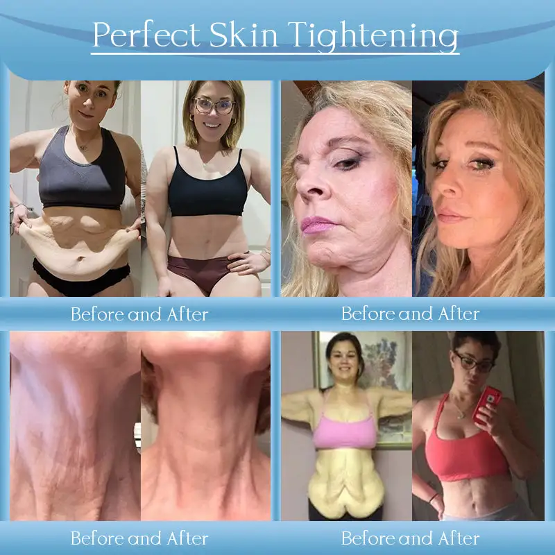 Anti-Wrinkle Skin Cream - Image 3