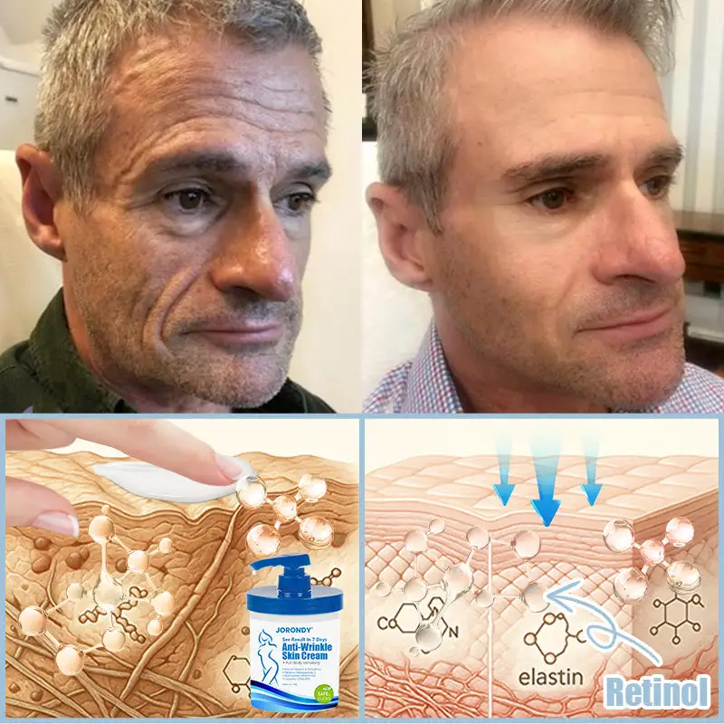 Anti-Wrinkle Skin Cream - Image 8