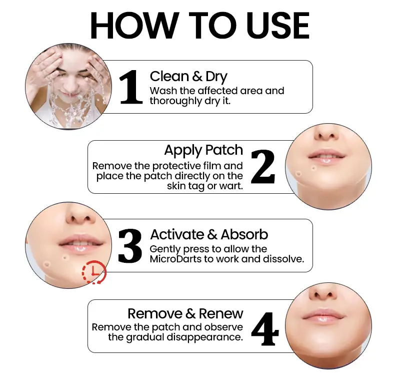 Pro MicroDarts TAG'Gone Patch - Image 5