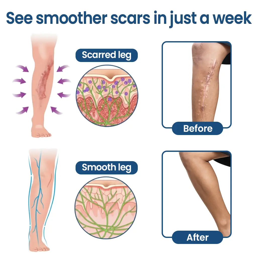 Triple-Roller Microcurrent ScarRepair Gel - Image 3