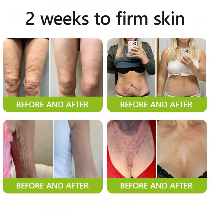 Botox Retinol Shot - Image 6