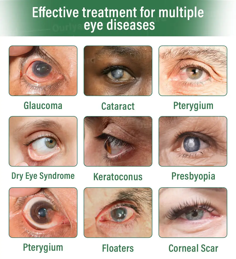 OptiClear DualTech Eye Drops - Image 3
