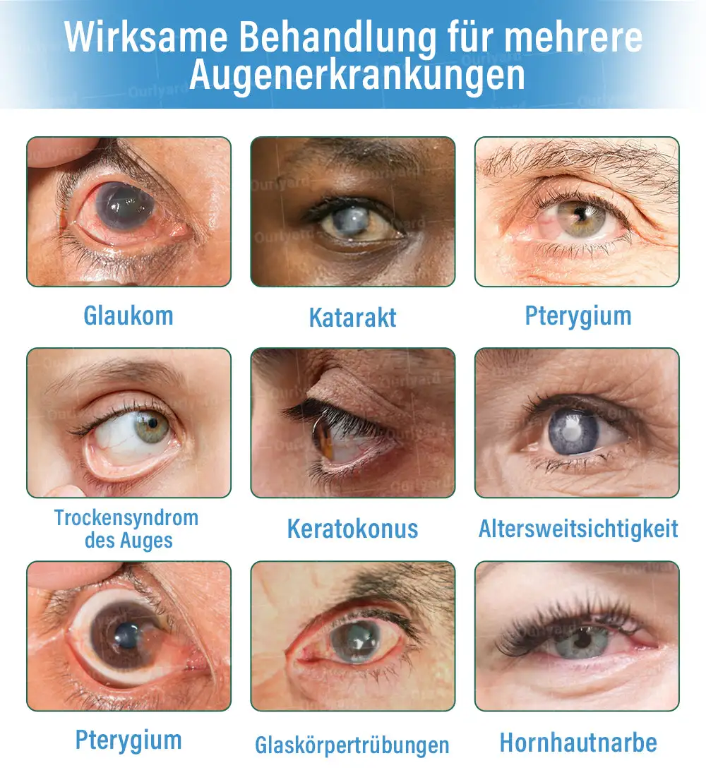 Supramolekulare Augentropfen - Image 4