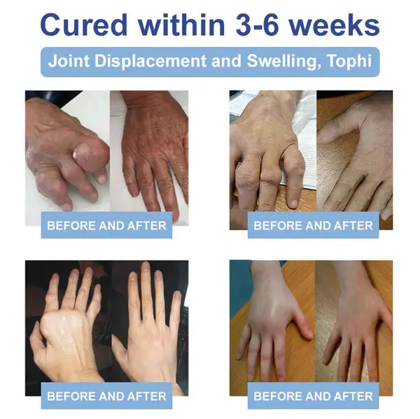 Magnesium Pain Healing Bone Cream - Image 12