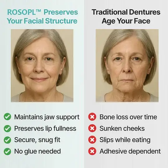 Flagship Premium Dentures - Image 6