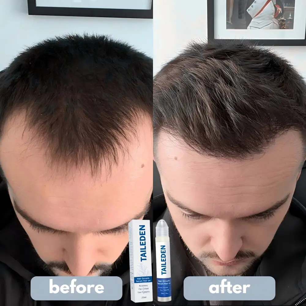 TAILEDEN Pro-Growth Roll-On Hair Growth Serum - Image 14