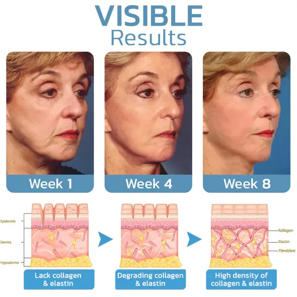 BotoxLUX Anti Aging Serum - Image 6