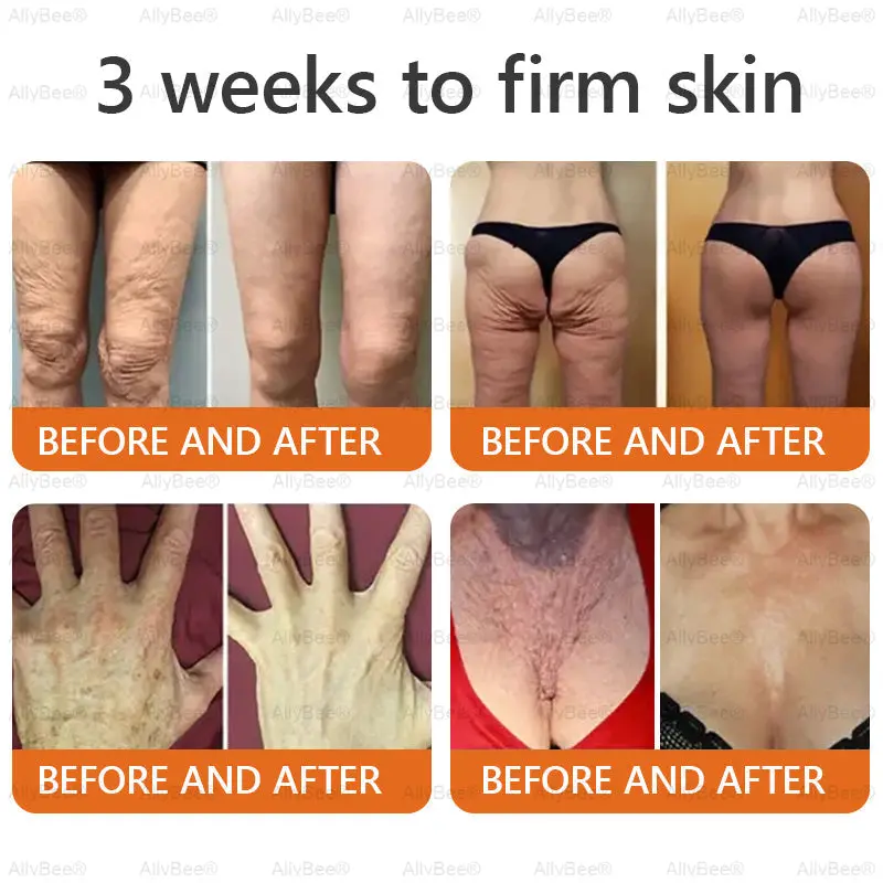 Bee Venom Cream - Image 6