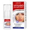 Vitiligo Treatment Spray Visible Results in Weeks, 100 Natural Steroid-Free