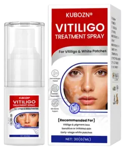 Vitiligo Treatment Spray Visible Results in Weeks, 100 Natural Steroid-Free