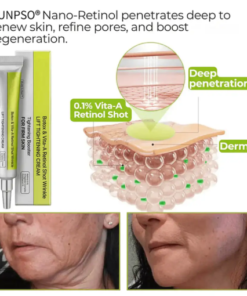 Advanced Peptide Botox-Style Vita-A Retinol Lifting Renewal Cream Today Only 70 OFF