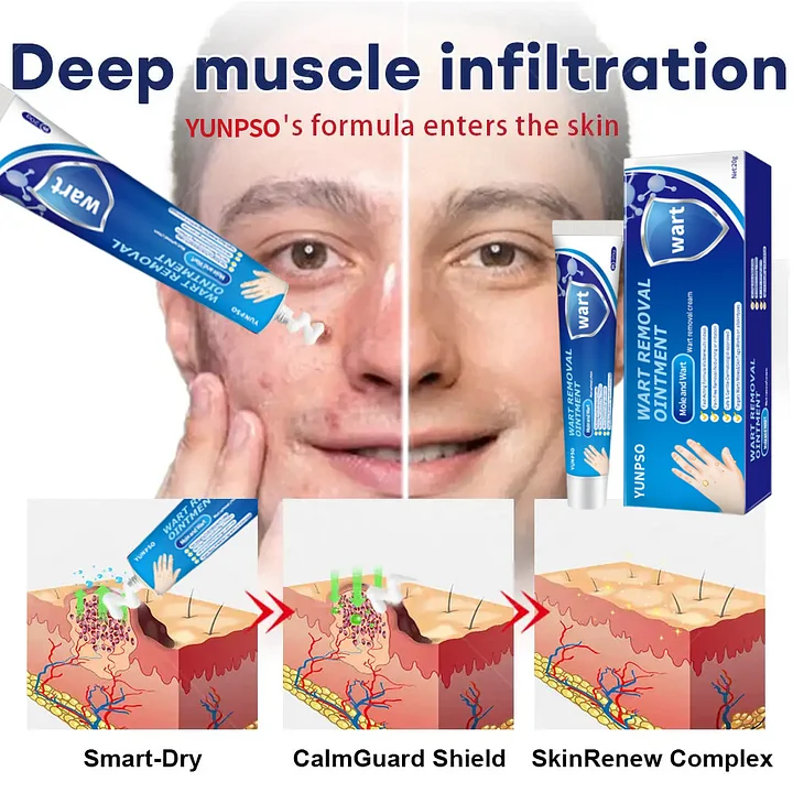Mole and Wart Removal Cream - Image 4