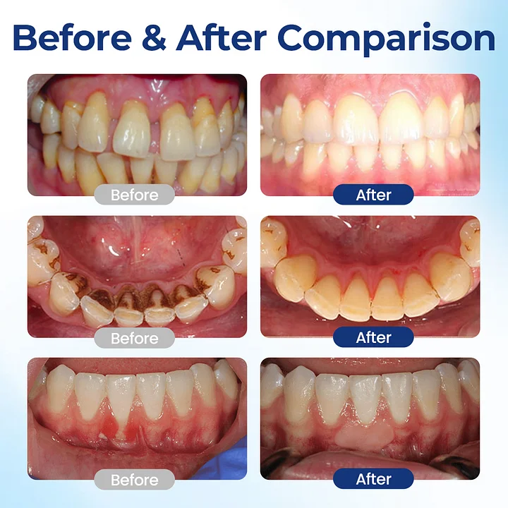 BeeTakt Oral Repair Solution Apitoxin - Image 3