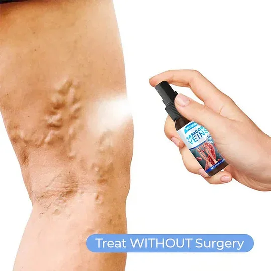 Sale Varicose Veins Relief Spray - Image 2