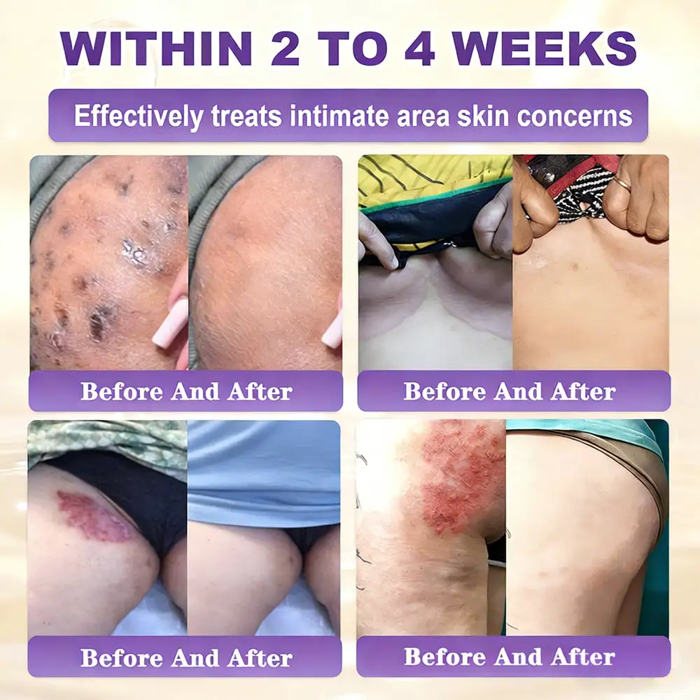 Biotin 10-in-1 Skin Restoration Cream - Image 10