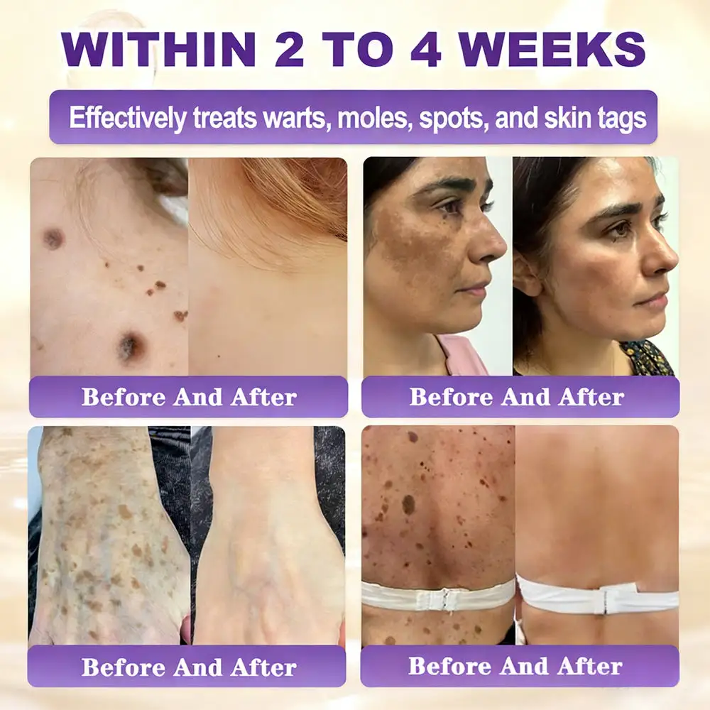 Biotin 10-in-1 Skin Restoration Cream - Image 11