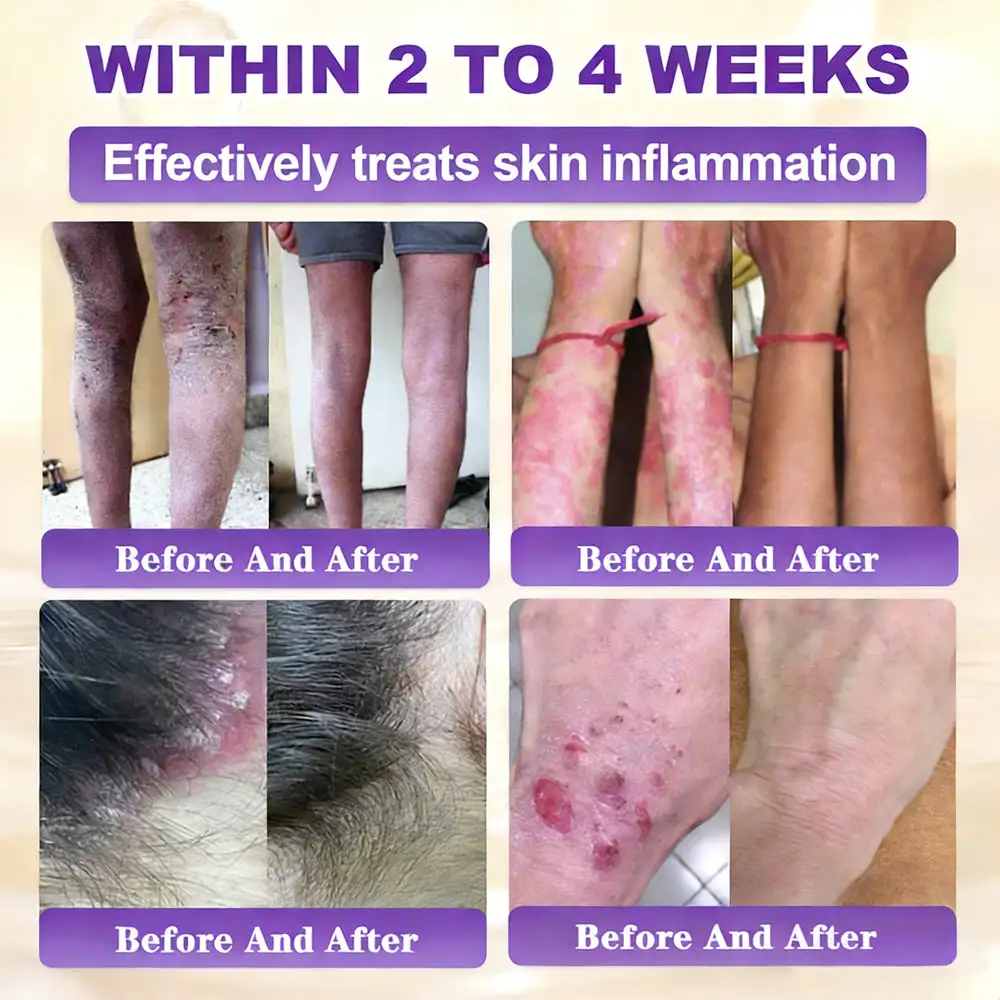 Biotin 10-in-1 Skin Restoration Cream - Image 12