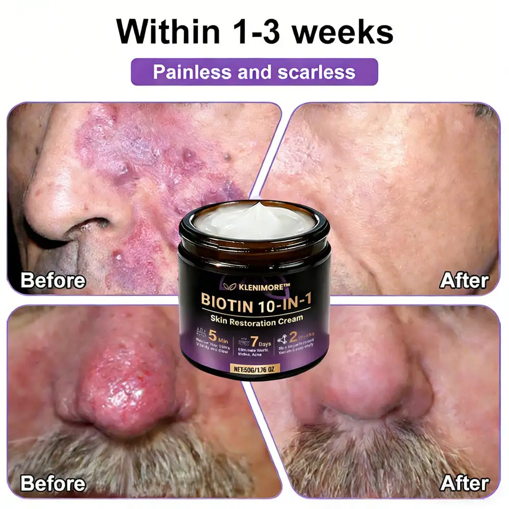 Biotin 10-in-1 Skin Restoration Cream - Image 2