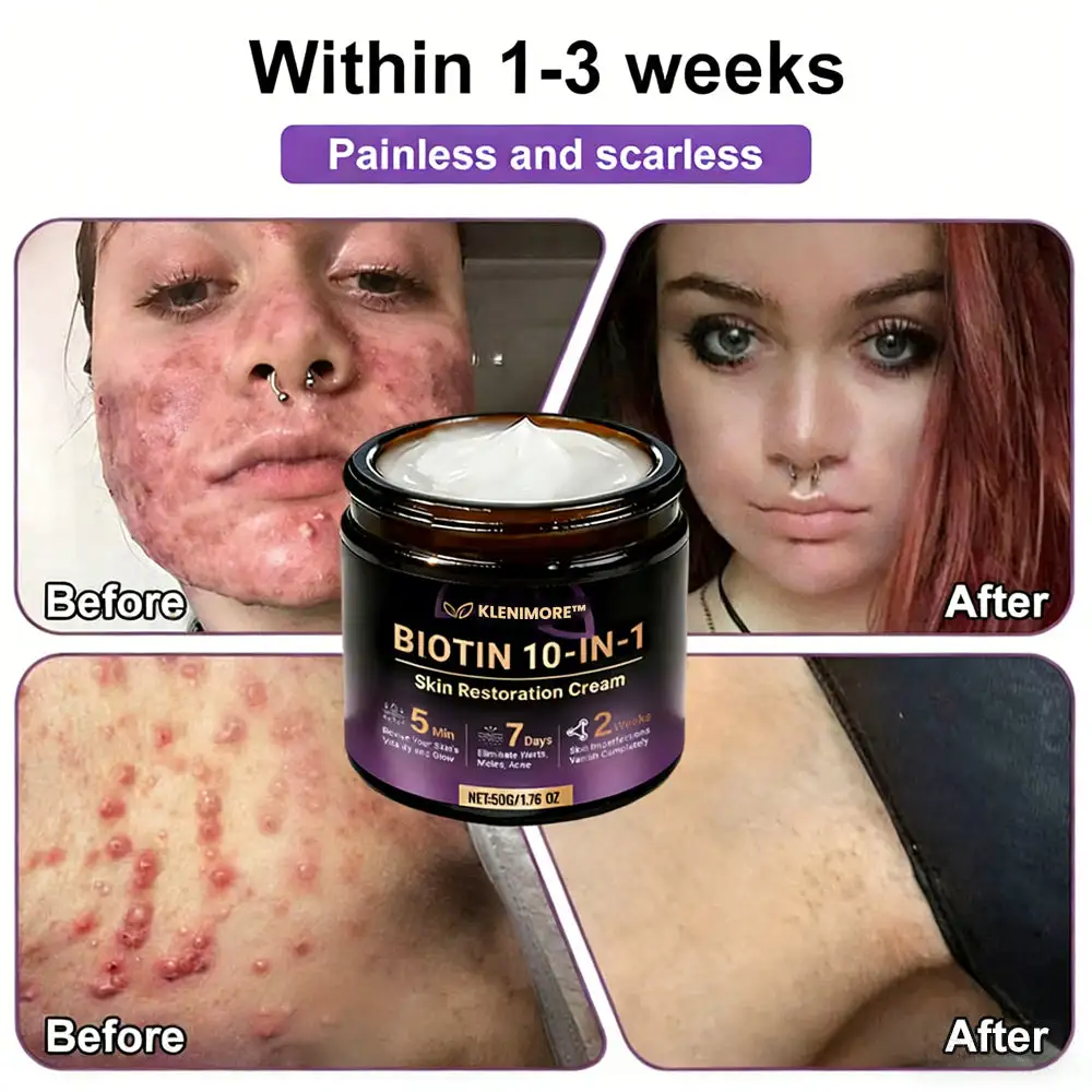 Biotin 10-in-1 Skin Restoration Cream - Image 3